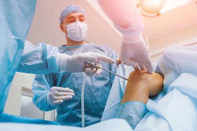 Knee Arthroscopy Surgery for ACL
