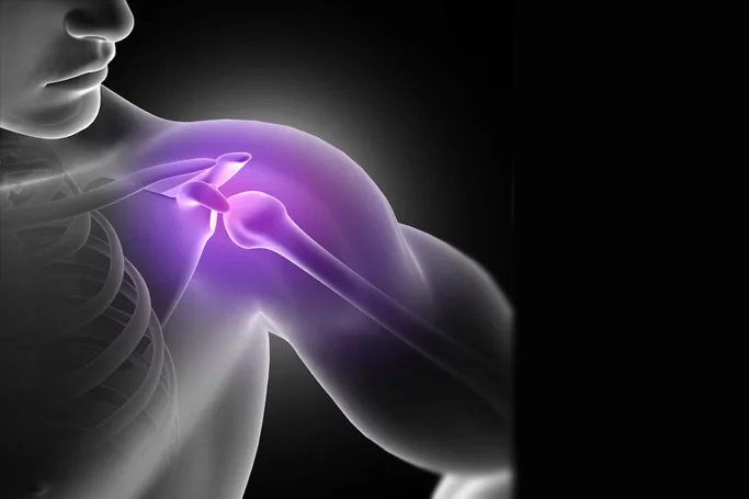 Shoulder Replacement Surgery